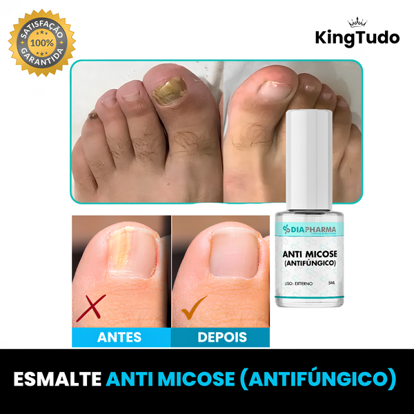 Esmalte Antifúngico DiaPharma™